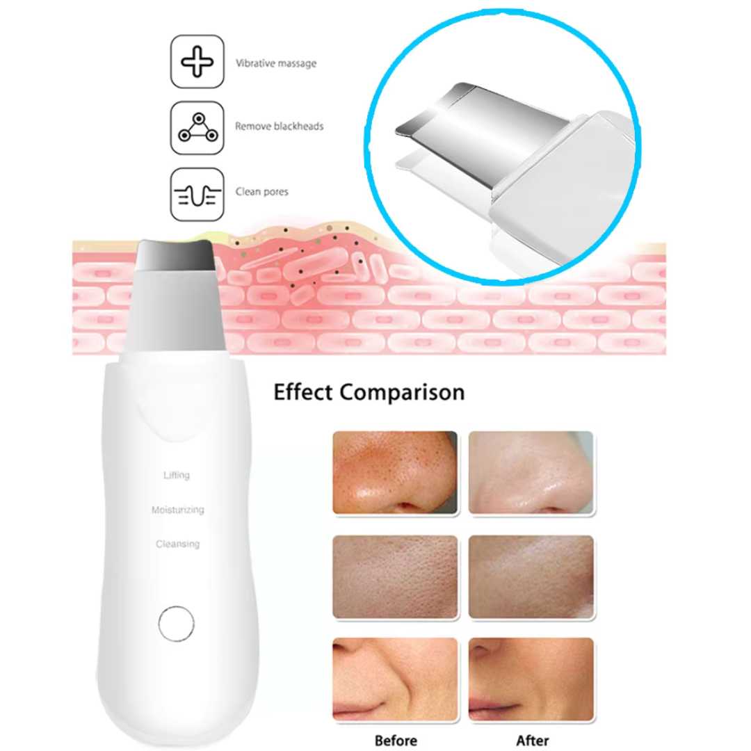 Ultrasonic Facial Skin Scrubber